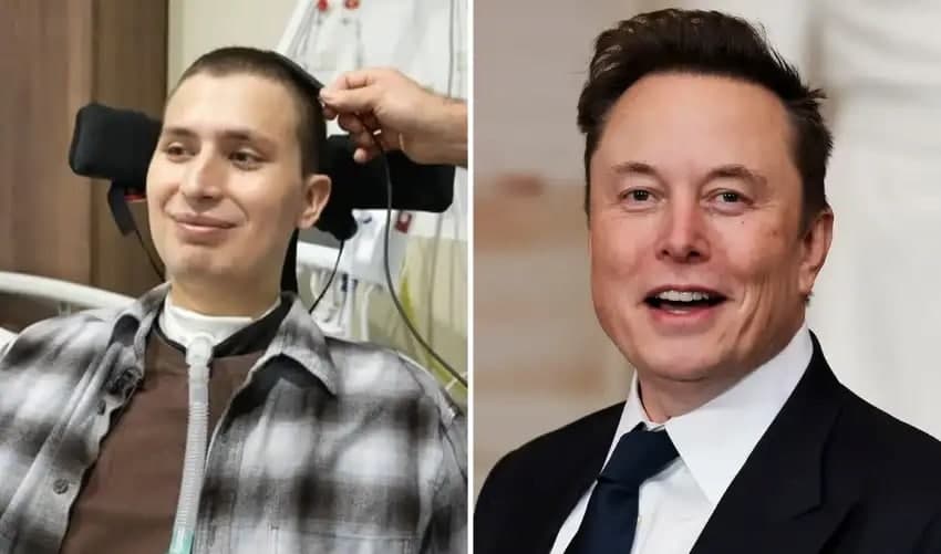 Joven parapléjico participa en el primer ensayo del chip cerebral de Elon Musk en Reino Unido