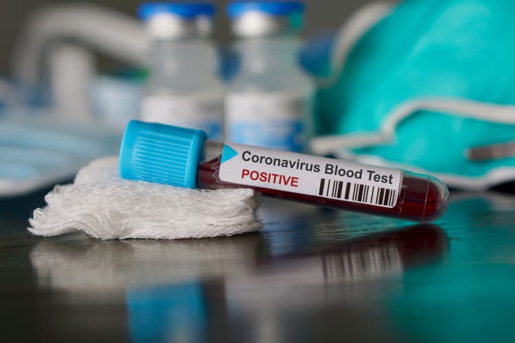Los anticuerpos contra la COVID-19 duran al menos ocho meses en la mayoría de casos de infección