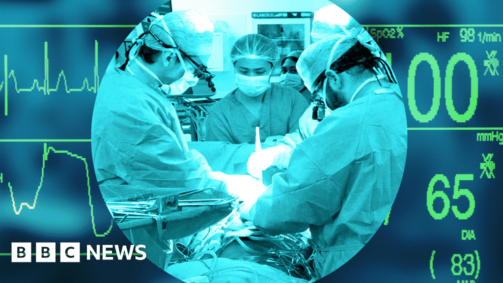 Reino Unido: sistema de trasplantes líder cae a la cola