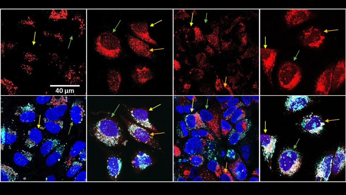 Cáncer: Nueva estrategia mata más células con menos quimio