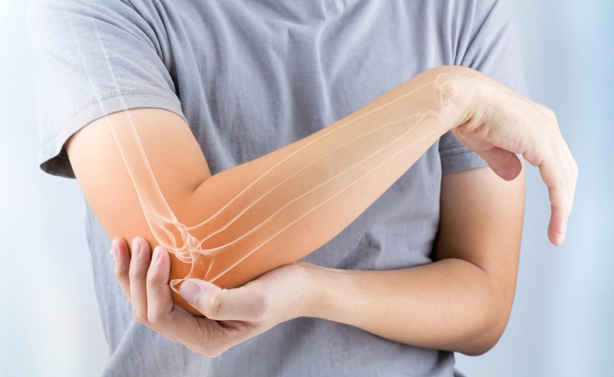 'La osteoporosis' cuando se debilitan los huesos