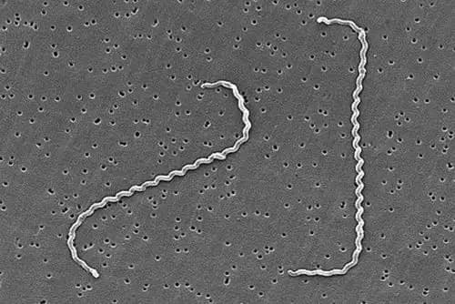 Leptospirosis en aumento: qué es, cómo se transmite y cuáles son sus síntomas