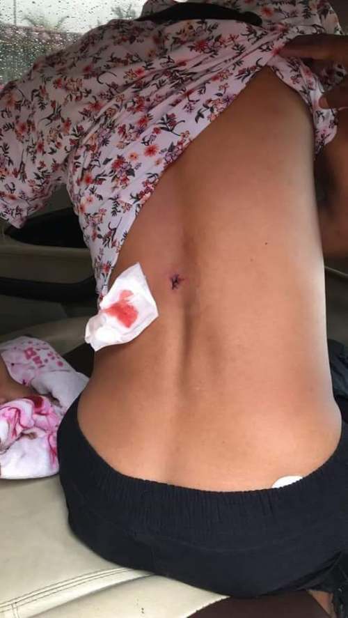 Motociclista resultó herido de bala en intervención policial