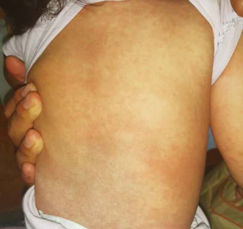Denuncian negligencia médica en el Showing