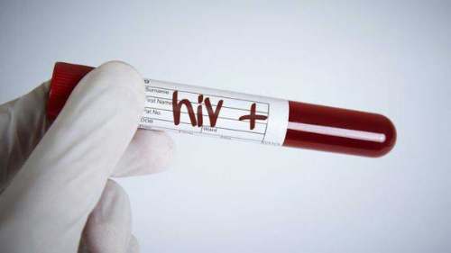 VIH: reducción de infección de en EEUU