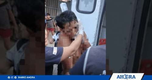 Hombre exige deuda y desfigura a su víctima con cuchillo