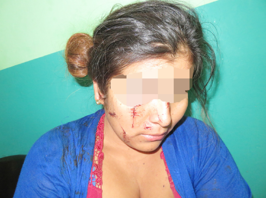 En gresca cortan la cara a estudiante