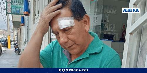 Escalofriante ataque a periodistas y autoridades en San Pablo de Pillao