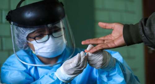 Variante brasileña tiene facilidad para ingresar a las células por lo que "es más infecciosa", dice epidemiólogo