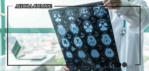 Científicos utilizan ultrasonido para potenciar medicamento contra el Alzheimer