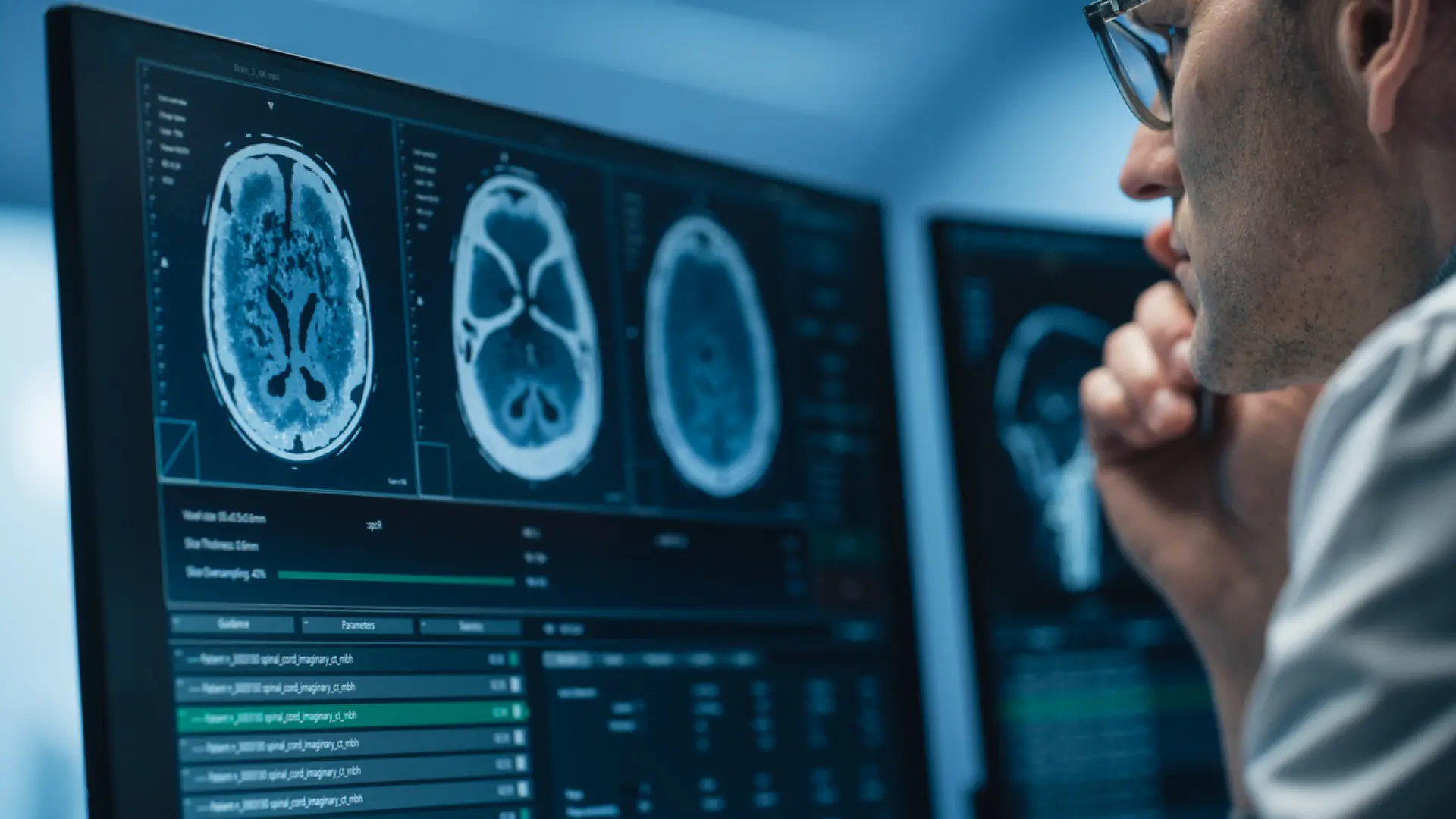 Nuevo parche bioadhesivo combate cáncer cerebral