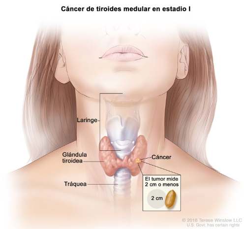 Inmunoterapia evita a pacientes oncológicos cirugías agresivas y tratamientos duros