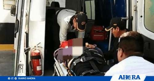 Joven herida tras accidente de tránsito en Tingo María; conductor se da a la fuga