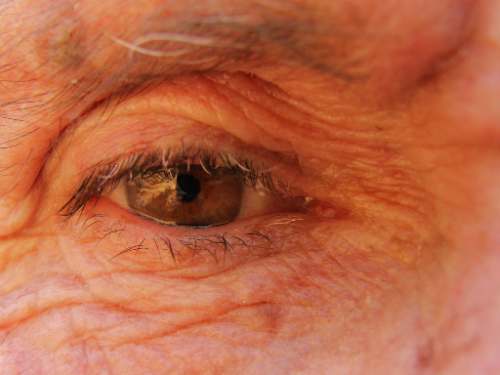 Terapia génica: nuevos tratamientos para el glaucoma