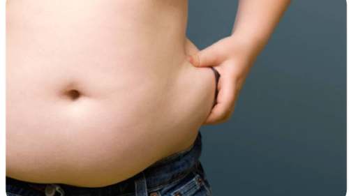 Clínica Mayo: conoce los tipos de obesidad