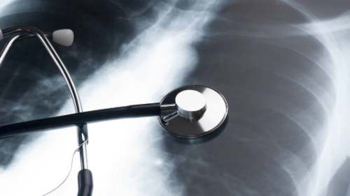 Si siente que sus pulmones fallan, aquí unos consejos...