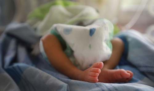 El insólito caso del bebé que nació con tres penes