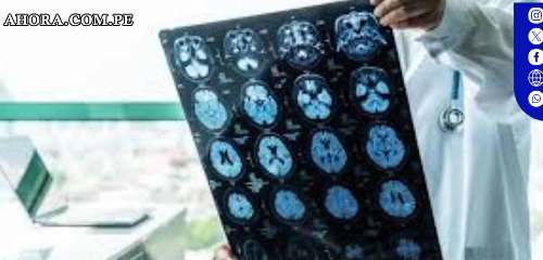 FDA aprueba nuevo fármaco para Alzheimer que promete retardar el deterioro cognitivo