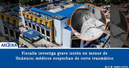 Fiscalía investiga grave lesión en menor de Huánuco; médicos sospechan de corte traumático