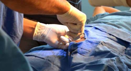 Varones mayores de 30 años podrán realizarse la vasectomía de forma gratuita