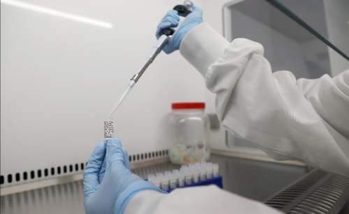 COVID-19: Científicos elaboran primera prueba rápida molecular en Perú