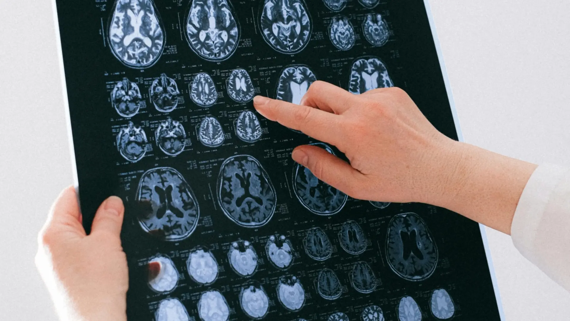 Estimular el cerebro promueve conductas menos egoístas