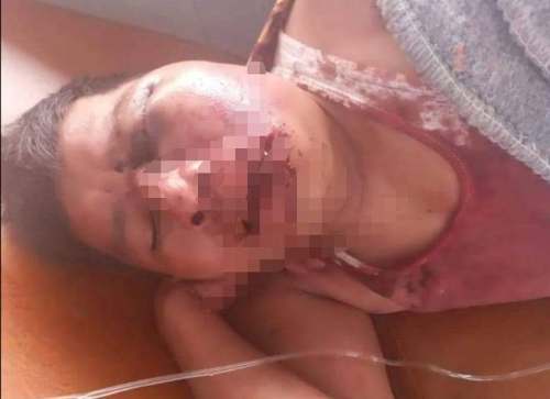 Intentan asesinar a líder indígena en puerto Bermúdez
