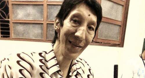 Margarito Machaguay, 'El hombre más alto del mundo”, falleció la madrugada de hoy