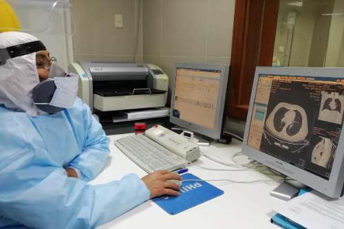 Según el director de EsSalud la cepa brasileña afectaría aún más los pulmones