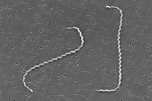 Leptospirosis en aumento: qué es, cómo se transmite y cuáles son sus síntomas