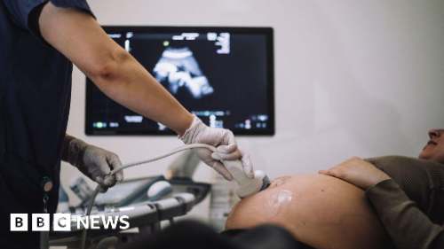 BBC: 58 bebés murieron por fallas en la atención médica