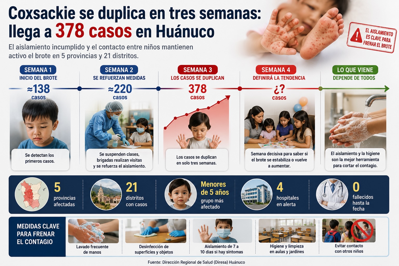 Coxsackie llega a 378 casos y Diresa advierte riesgo por aislamiento incumplido