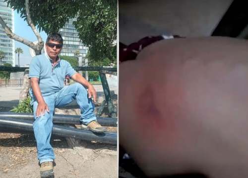 Denuncian a padre por presunta golpiza a su hija de dos años en Macuya