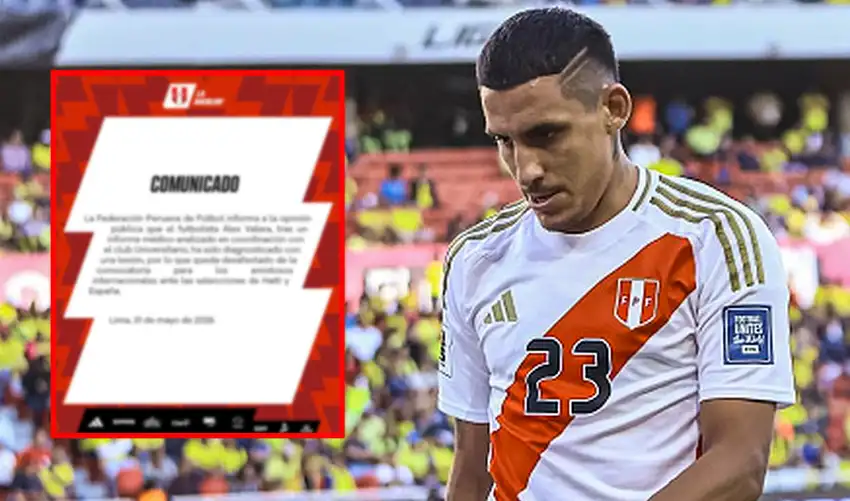 Valera queda fuera de Perú