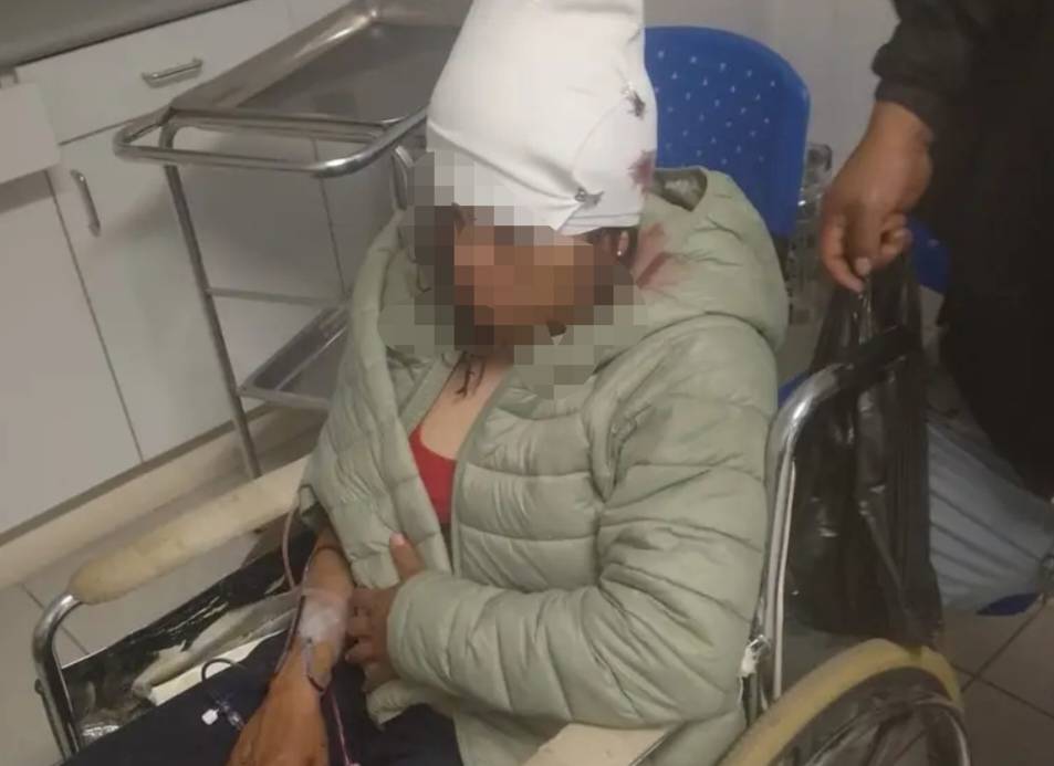 Policía queda herida tras caer motofurgón a una pendiente en Chupán