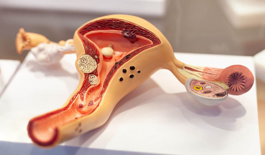 Solo 2% de niñas y adolescentes recibió la vacuna contra el virus del papiloma