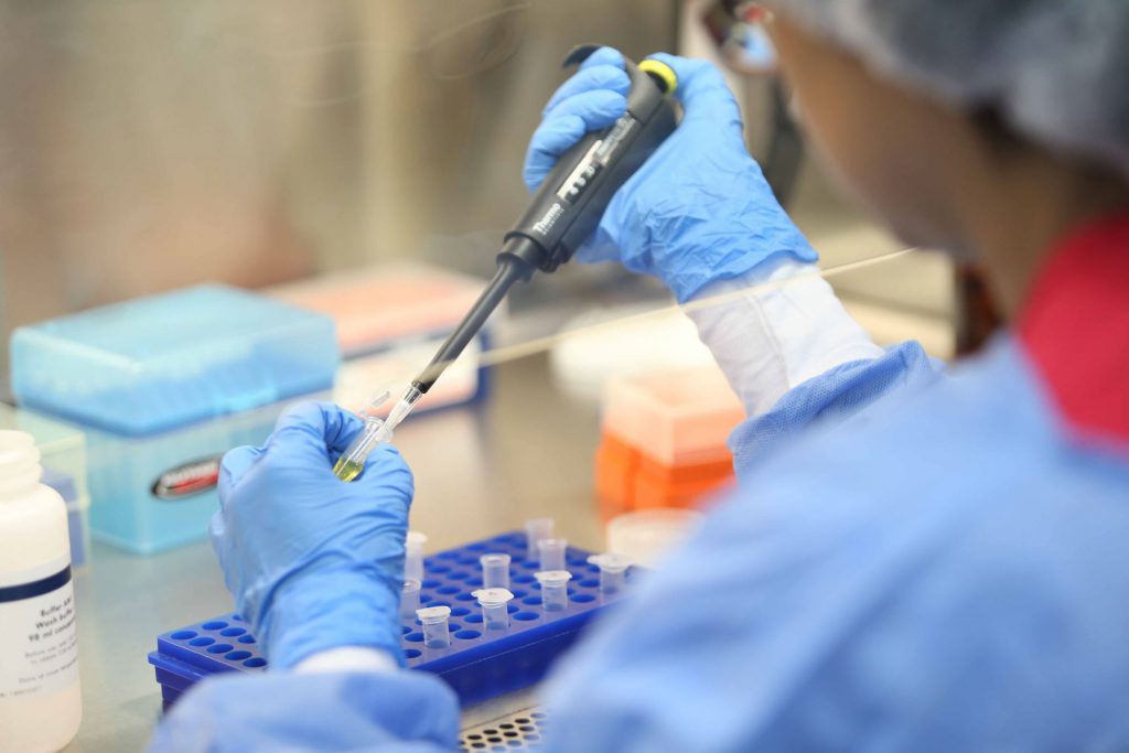 Perú procesa más de 3 millones de muestras por COVID-19