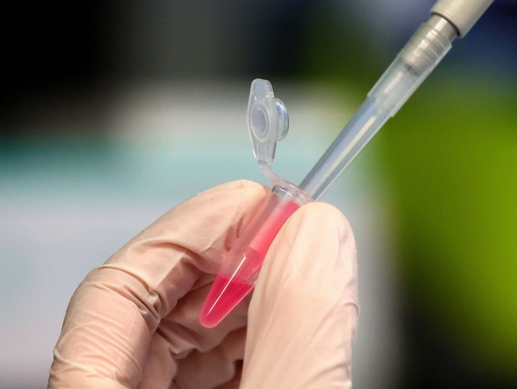 ¿Qué tan dispuestos están los peruanos a ponerse la vacuna contra el COVID-19?