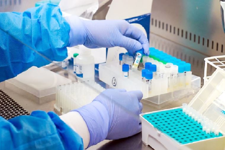 Perú procesa hasta 6000 pruebas moleculares al día