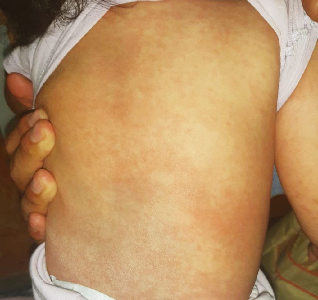 Denuncian negligencia médica en el Showing