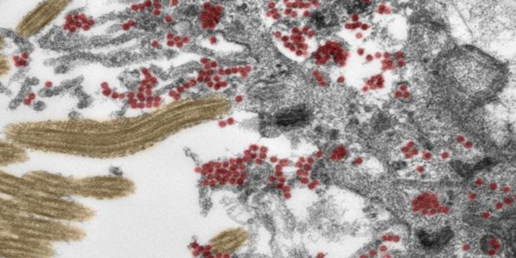 Descubren cómo el coronavirus logra entrar en el cerebro