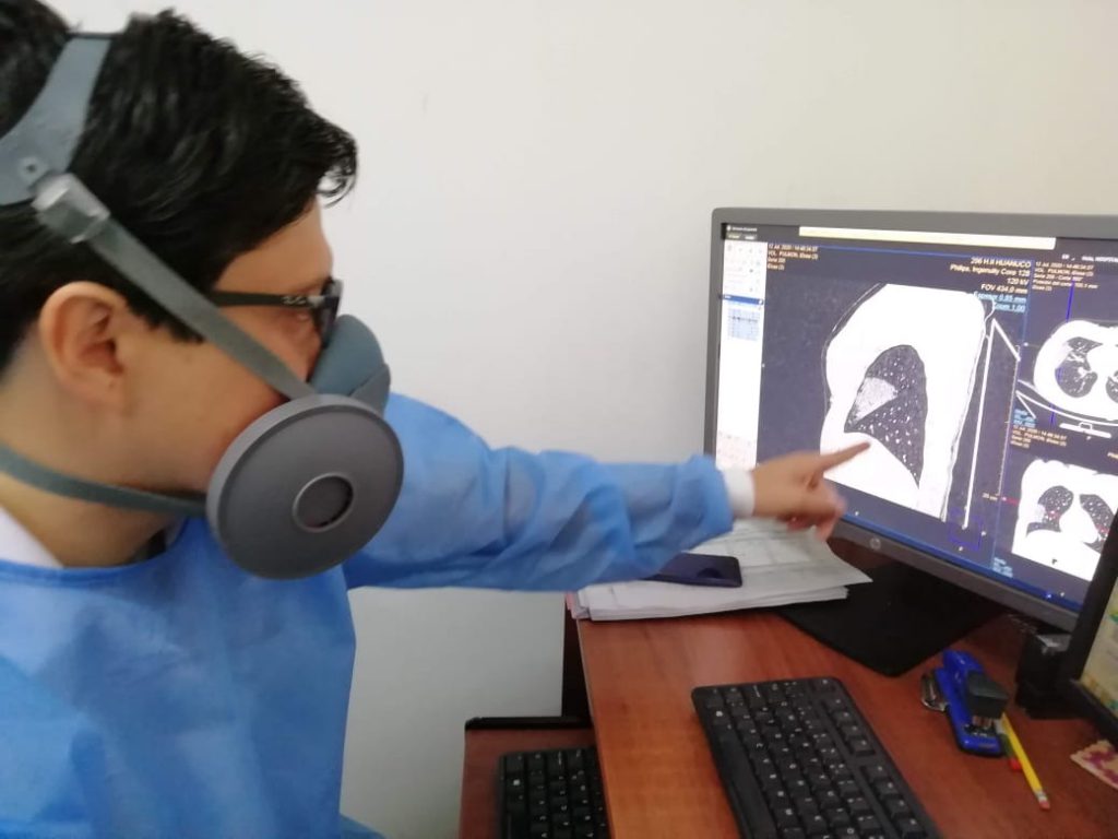 Aumentan ingresos de pacientes menores de 40 años con coronavirus en EsSalud Huánuco