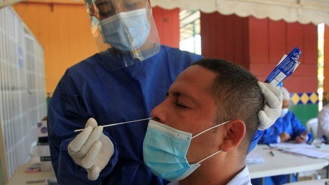 EE.UU.: la variante británica del coronavirus fue detectada en ocho estados