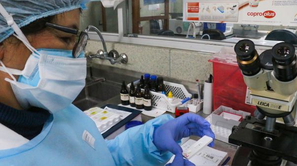 Ministerio de Salud reportó 110 fallecidos por la COVID-19 y más de 1 400 contagios en el último día