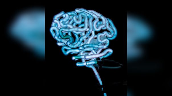 El reguetón provoca mayor actividad cerebral que escuchar clásica o folclore, según un estudio