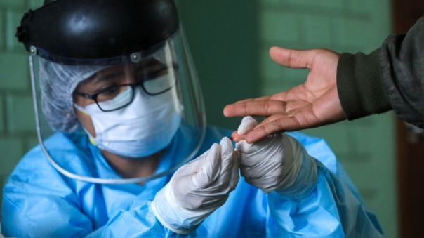 Minsa reporta 50 fallecidos y 291 casos nuevos de la COVID-19 en el último día