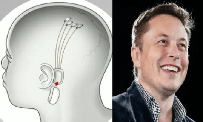 Computadora en el cerebro humano