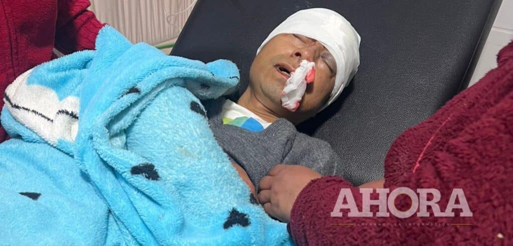 Paucartambo: Motociclista atropella a transeúnte y lo deja malherido