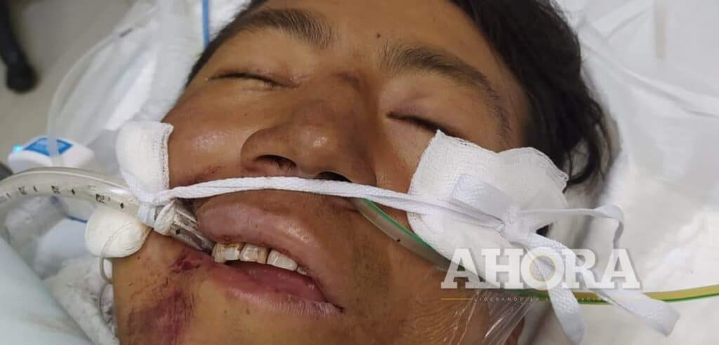 Paciente no identificado lleva dos días internado en el hospital Daniel Alcides Carrión