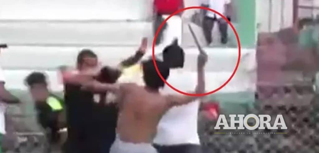 Árbitro es atacado a machetazos en la Liga de Chanchamayo